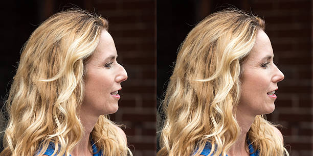 antes y después de la cirugía plástica - makeover series fotografías e imágenes de stock