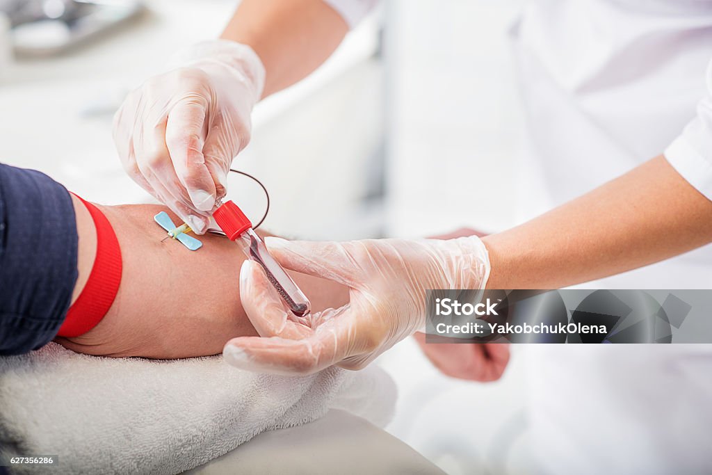 General practitioner doing blood test Close up of doctor hands taking blood from male vein into tube by catheter Blood Donation Stock Photo