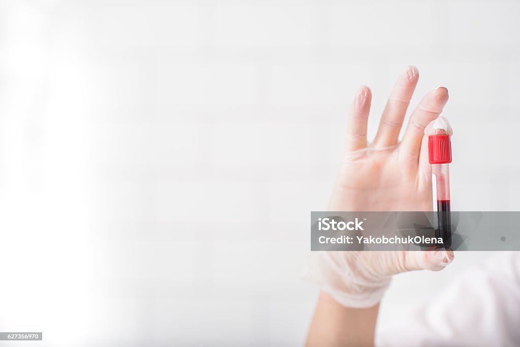 Scientist analyzing blood test tube Close up of doctor hand holding blood sample. Copy space in left side Blood Stock Photo