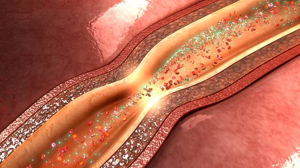 istock Relaxation of coronary artery 627831706