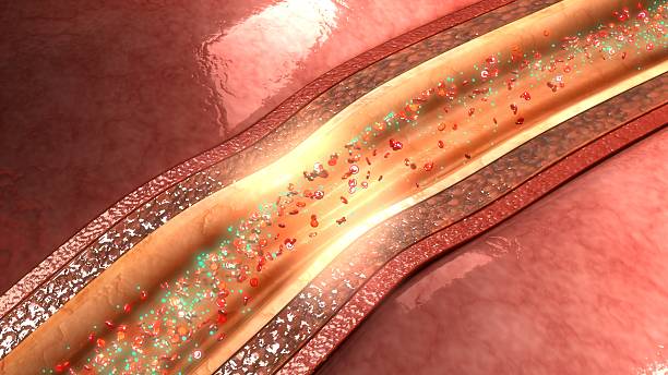 istock Relaxation of coronary artery 627831750