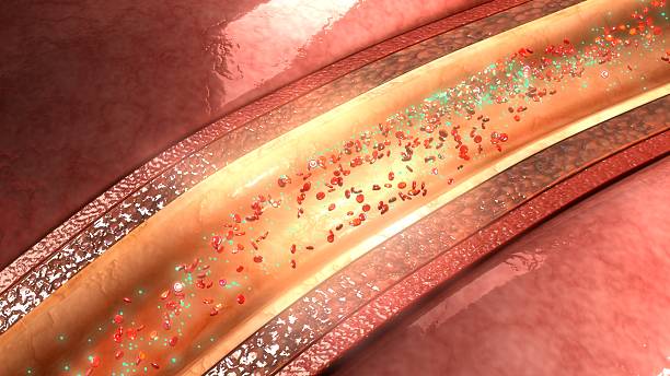 istock Relaxation of coronary artery 627831792