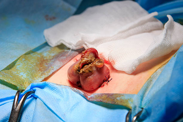 Rectum Sectional With Feces Rectum sectional with feces inside closeup during the colostomy surgery stomach knot stock pictures, royalty-free photos & images