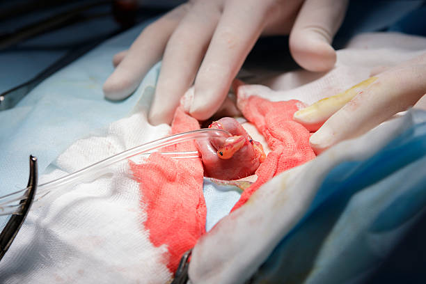 istock Intestine and the Surgeon Hands 627942268