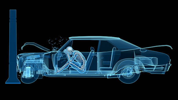 istock X-ray of a man in a car accident 628031136