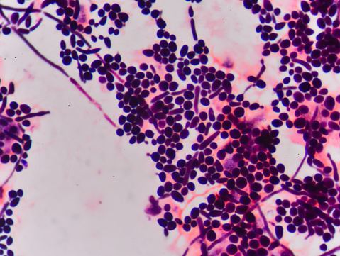 Branching budding yeast cells with pseudohyphae in  gram stain fine with microscope.