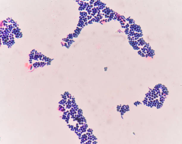 istock Branching budding yeast cells with pseudohyphae in  gram stain f 628311170