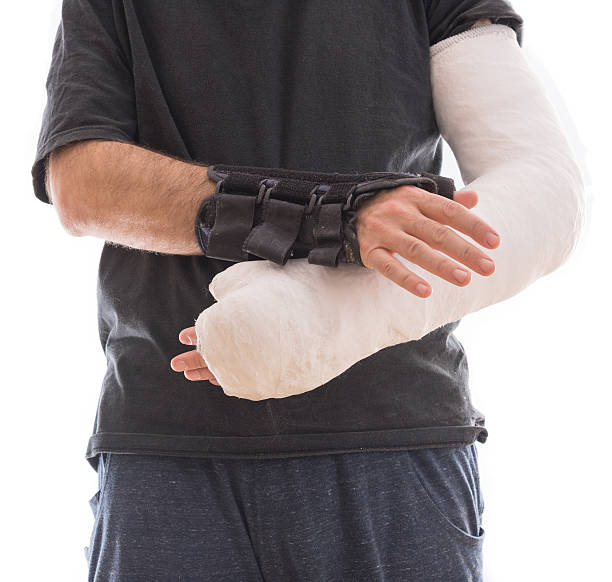 istock Young man wearing a long arm cast and a splint 628361836