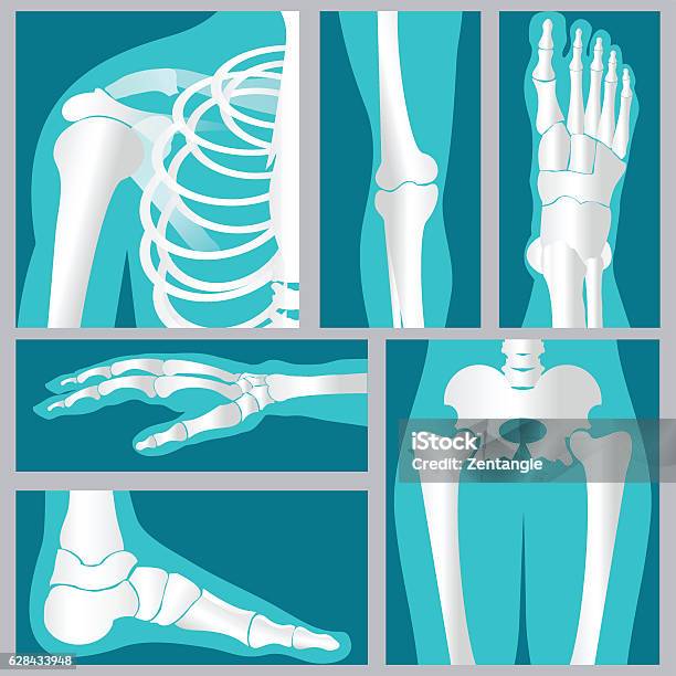 Set Of Xray Of Human Stock Illustration - Download Image Now - Joint - Body Part, Pain, Human Leg