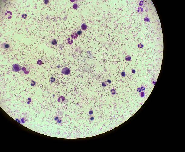 istock Malaria, Plasmodiun falciparum 628712602