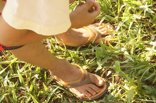 istock Boy hand scratching his own legs and feet due to 629274302