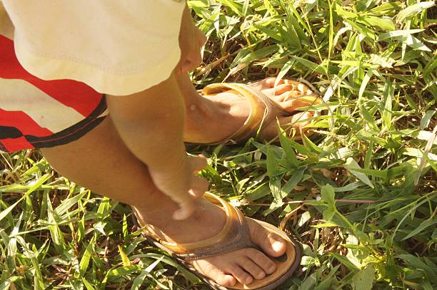 istock Boy hand scratching his own legs and feet due to 629274326