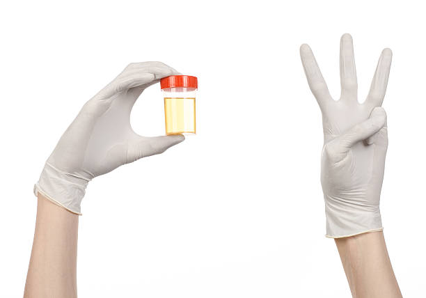 istock Medical theme: doctor's hand in white gloves holding a transpare 629323538