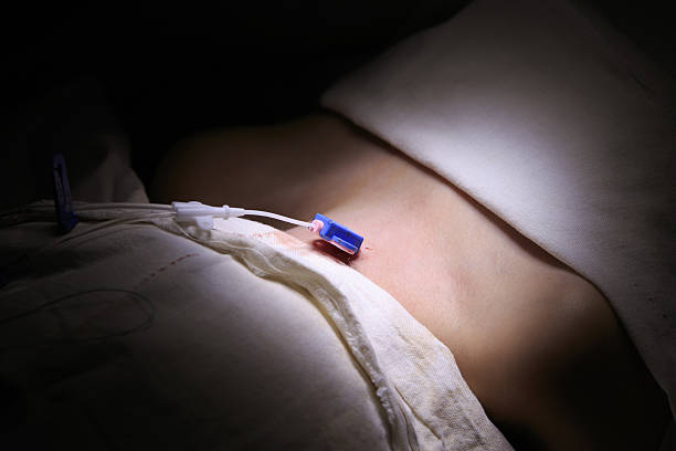 Central Line With Sensor Central venous catheter with a sensor installed into a neck of a boy close-up cvc stock pictures, royalty-free photos & images
