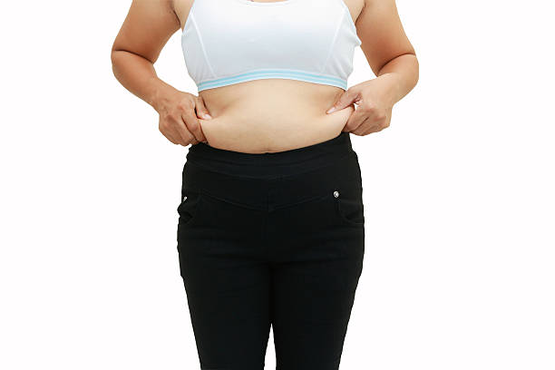 abdominal surface of fat woman stock photo