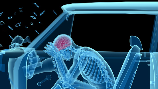 X-ray of a man in a car accident, frontal collision, showing skeleton and brain. Side view. Isolated on black background. Great to be used in medicine works and health.