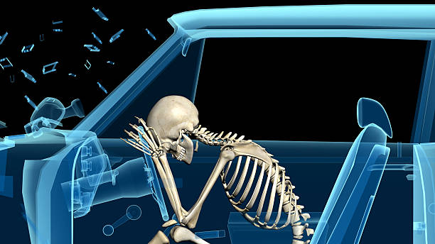 istock Human anatomy in a car crash, skeleton 629568510