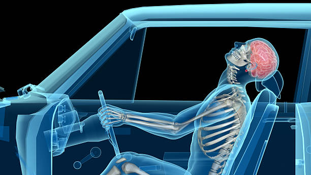 anatomia humana em um acidente de carro, ossos e cérebro - the human body anatomy rear view men - fotografias e filmes do acervo