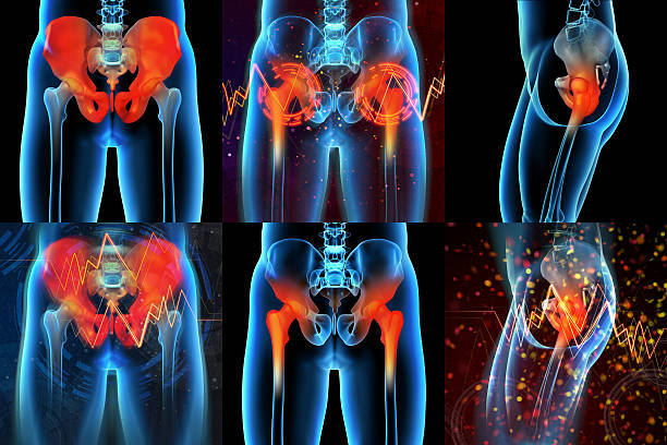 3d rendering medizinische illustration der schmerzhaften kreuzbein - ischium stock-fotos und bilder