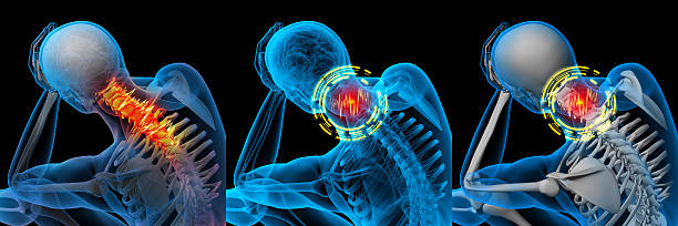 Ilustração 3D renderizada de dor no pescoço - foto de acervo