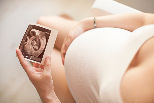 Pregnant woman showing ultrasound picture of baby