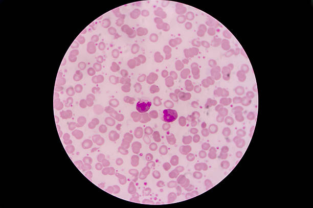 istock Slide blood smear show giant platelet and monocyte under microsc 629950852