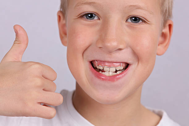 istock Happy smiling boy with orthodontic appliance 630017544