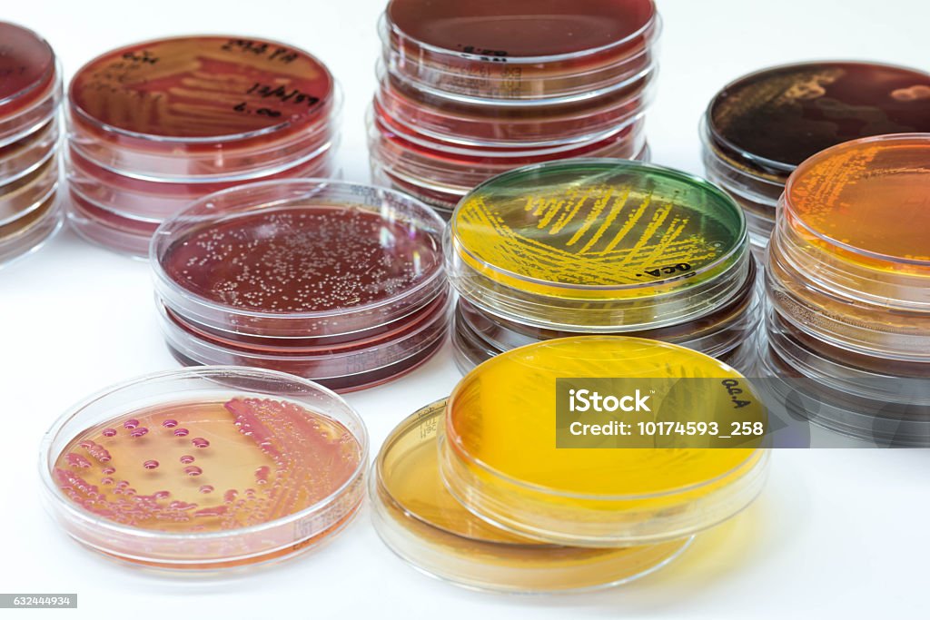 Bacterial colonies culture growth on selective media.Gram positi Bacterial colonies culture growth on selective media.Gram positive and gram negative growth. Petri Dish Stock Photo