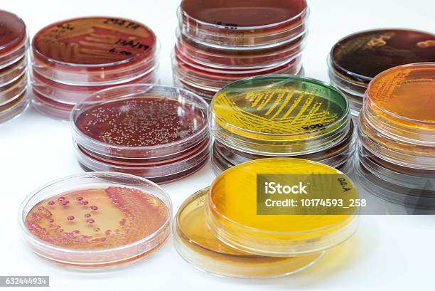 Bacterial Colonies Culture Growth On Selective Mediagram Positi Stock Photo - Download Image Now