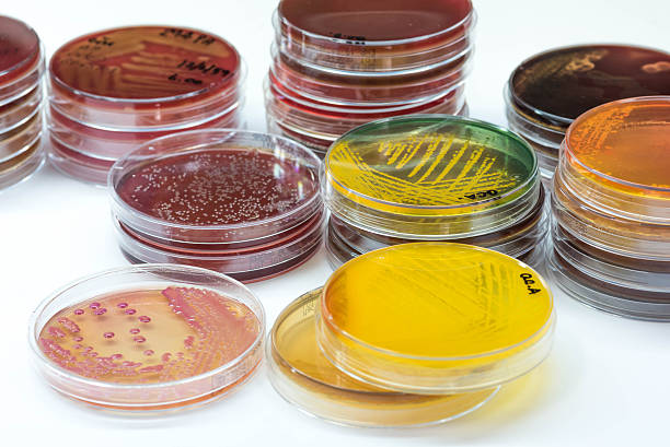 bacterial colonies culture growth on selective media.gram positi - petri dish agar jelly bacterium science imagens e fotografias de stock