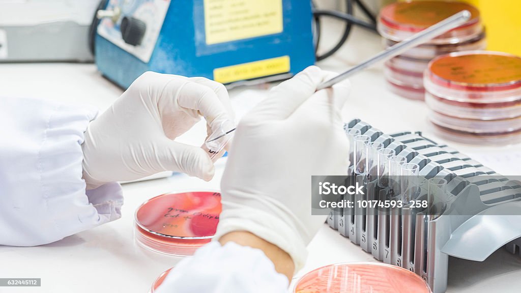 Close up on hand medical technicians working on bacterial cultur Close up on hand medical technicians working on bacterial culture and drug resistance of pathogens in laboratory. Rebellion Stock Photo