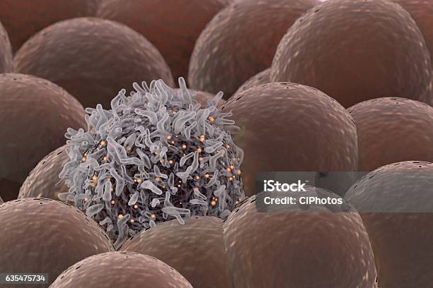 Cancer Cell Among Healthy Cells Stock Photo - Download Image Now - Cancer Cell, Melanoma, Cancer - Illness