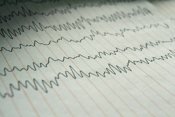 elettroencefalogramma eeg - pulse trace computer monitor eeg equipment foto e immagini stock