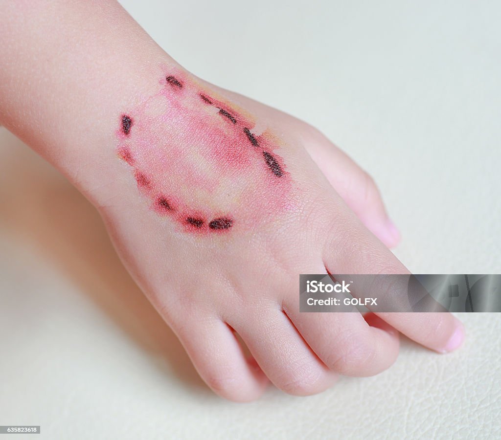 Sticker wound and blood from a bite human teeth Sticker wound and blood from a bite human teeth on child hand, Dress up tattoos, Halloween concept. Adult Stock Photo