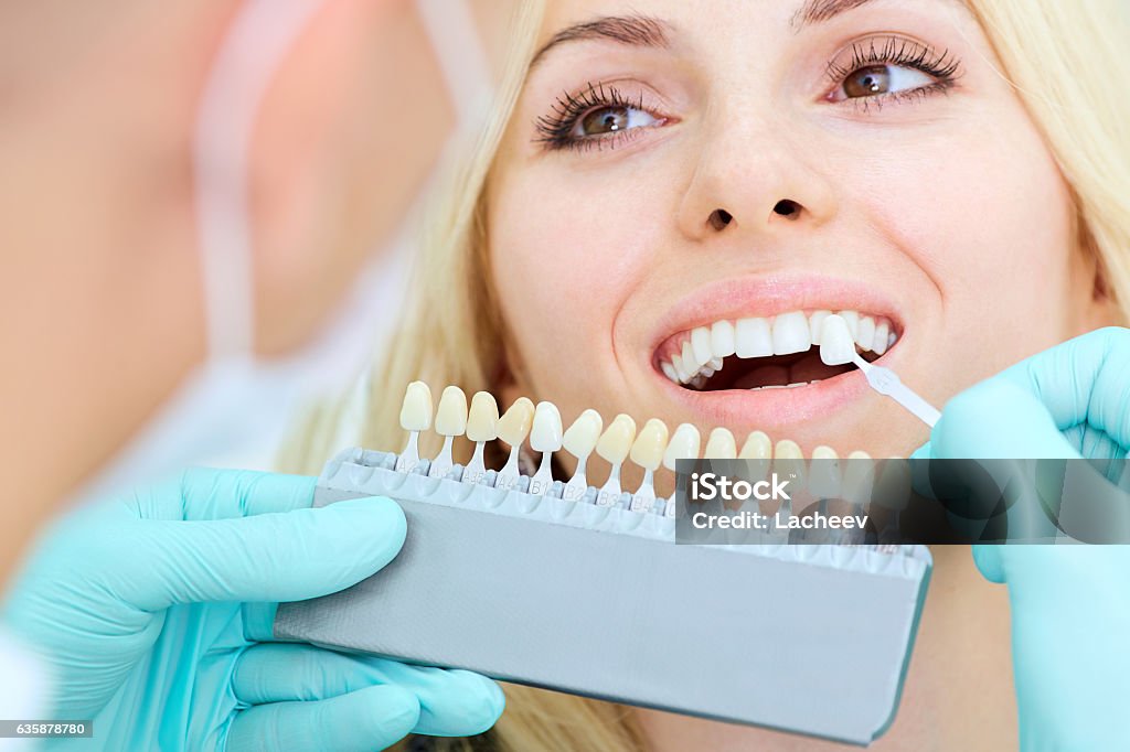 Gros plan d’une fille avec un beau sourire chez le dentiste - Photo de Blanchiment des dents libre de droits