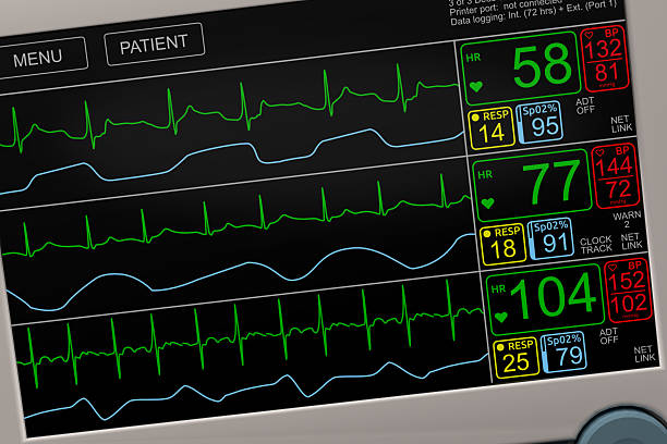 vital signs icu monitor closeup - human heart surveillance computer monitor pulse trace stock-fotos und bilder