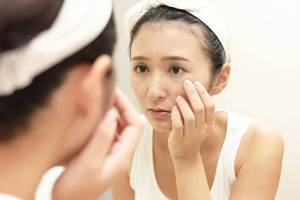 istock Young woman having skin problems 636034630