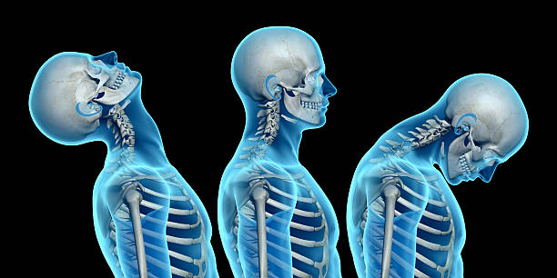 Anatomy of human body, showing neck injuries like whiplash effect Anatomy of human body, showing neck injuries like whiplash effect. With skeleton and skin. Side view.  Isolated on white background. Great to be used in medicine works and health. cervical vertebrae photos stock pictures, royalty-free photos & images