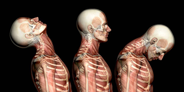 Anatomy of human body, showing neck injuries like whiplash effect Anatomy of human body, showing neck injuries like whiplash effect. With muscles and skeleton. Side view.  Isolated on white background. Great to be used in medicine works and health. cervical vertebrae photos stock pictures, royalty-free photos & images