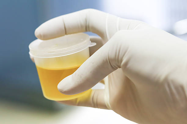 urine sample Healthcare And Medicine. Medical urine test, close-up 1234 stock pictures, royalty-free photos & images