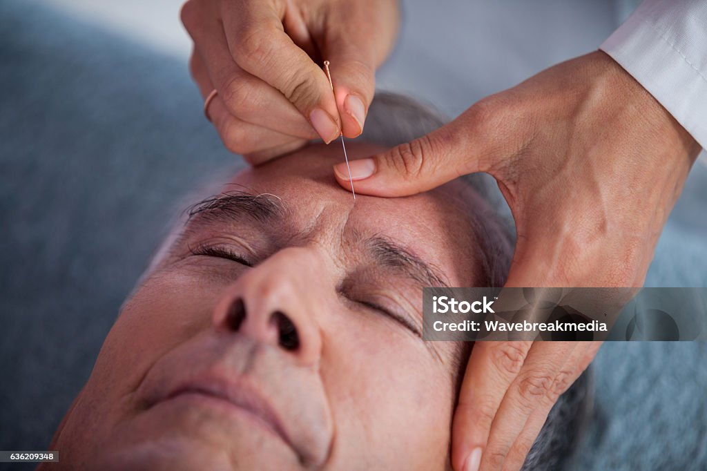 Senior man receiving head massage from physiotherapist Senior man receiving head massage from physiotherapist in clinic Acupuncture Stock Photo