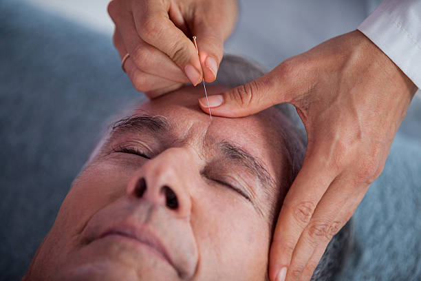 Senior man receiving head massage from physiotherapist Senior man receiving head massage from physiotherapist in clinic acupuncture photos stock pictures, royalty-free photos & images