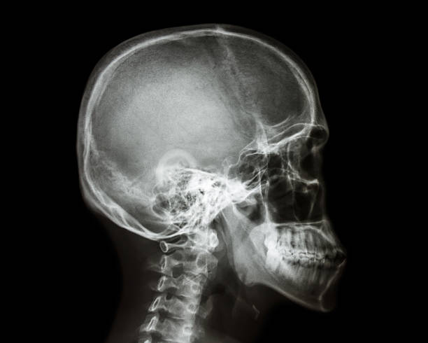 película de rayos x cráneo y columna cervical vista lateral - animal skull animal bone anatomy animal fotografías e imágenes de stock