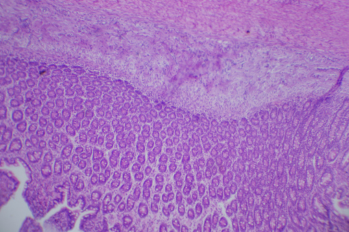 Microscopic image of dense connective tissue