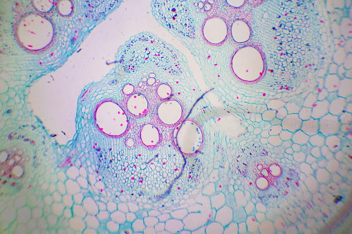 Ovary cystadenoma biopsy under light microscopy zoom in different area