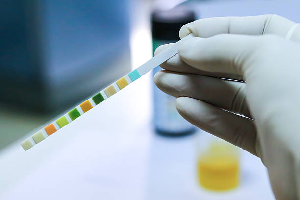 istock Check-up. Medical report and urine test strips 636359116