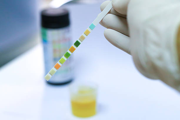 check-up.   medizinische bericht und test-streifen urin  - bacterium biology control food stock-fotos und bilder