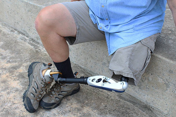 istock Amputee seated with leg and prosthesis crossed 636475380