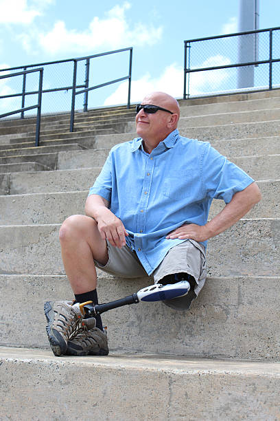 istock Amputee man seated with leg and prosthesis crossed 636476254