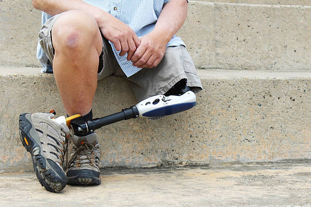Amputee man seated with legs crossed